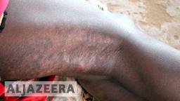 UN Reports 600+ Deaths in South Sudan Ethnic Clashes