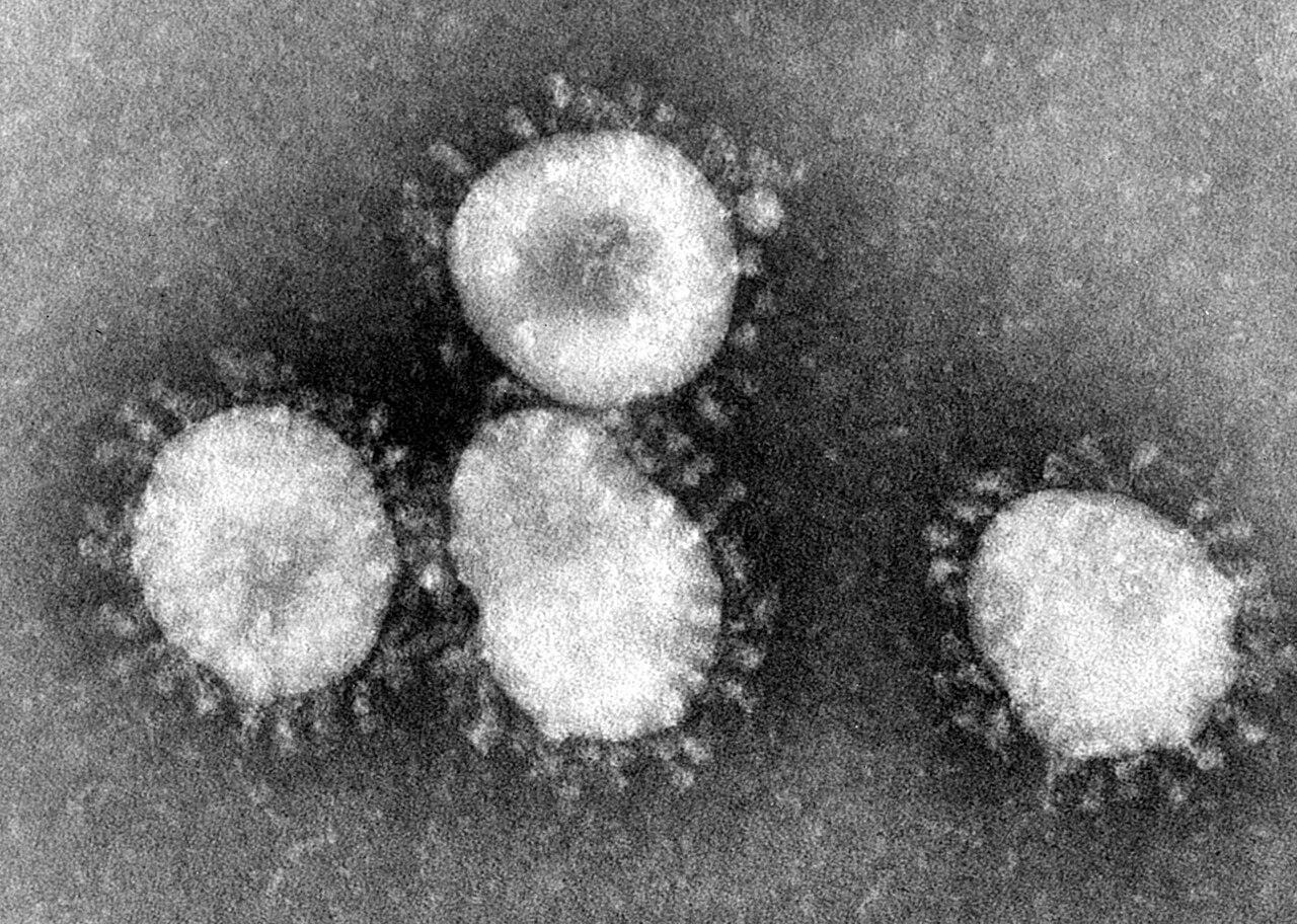 Moment image for SARS outbreak prompts significant public health measures in Canada.